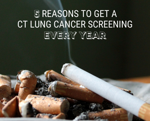 5 Reasons to Get a CT Lung Cancer Screening Every Year