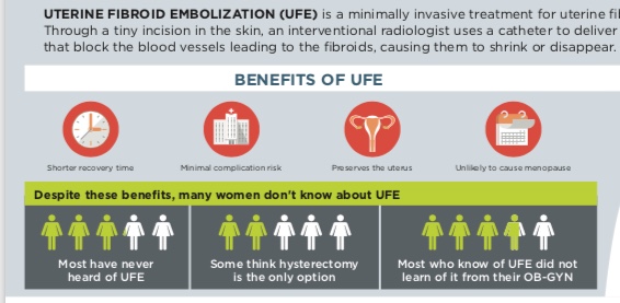 Benefits of UFE
