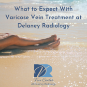 What to Expect With Varicose Vein Treatment at Delaney Radiology