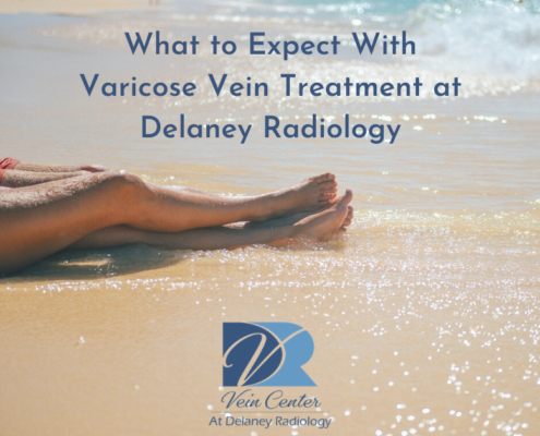 What to Expect With Varicose Vein Treatment at Delaney Radiology