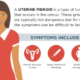 Uterine Fibroid Tumor Symptoms