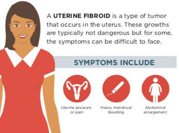 Uterine Fibroid Tumor Symptoms