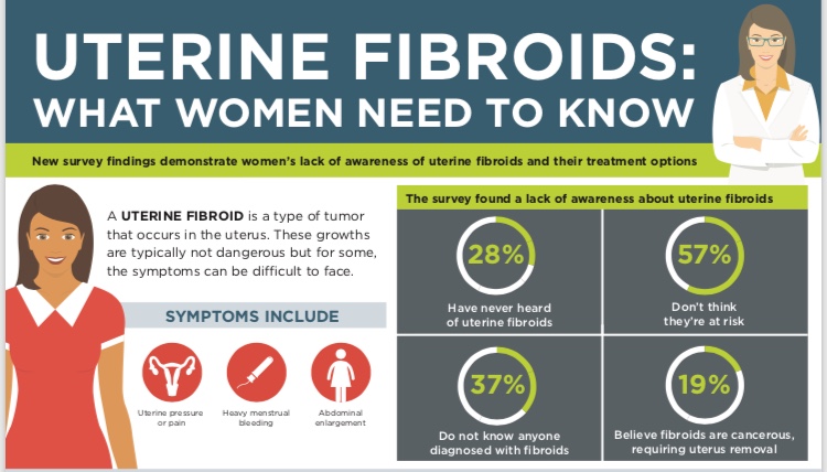 What you should know about Uterine Fibroids