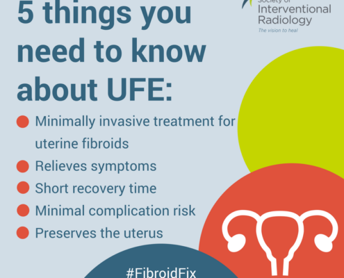 5 Things You Need to Know About UFE